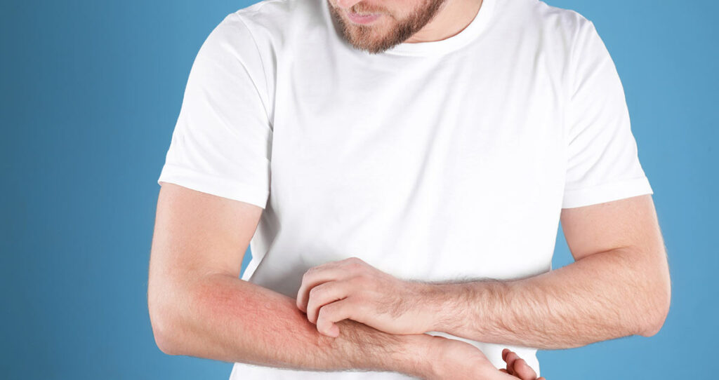 hombre rascándose el brazo