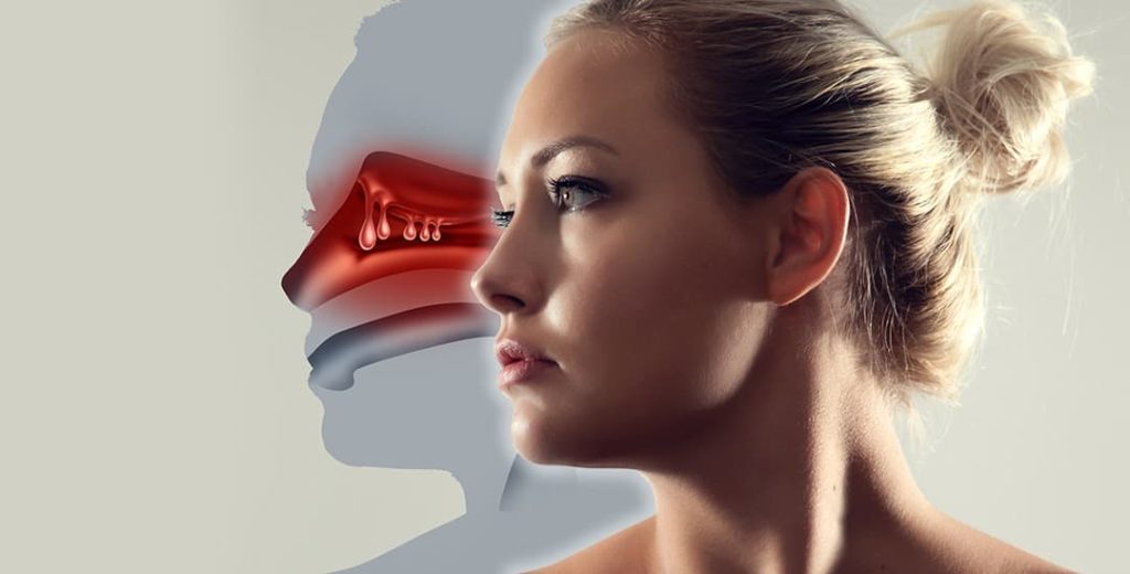Perfil del rostro de una mujer para el concepto de pólipos nasales