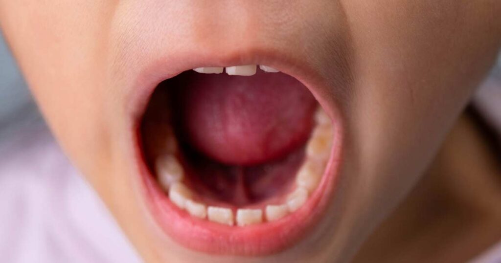 Niño tomando medicamentos para la alergia debajo de la lengua.