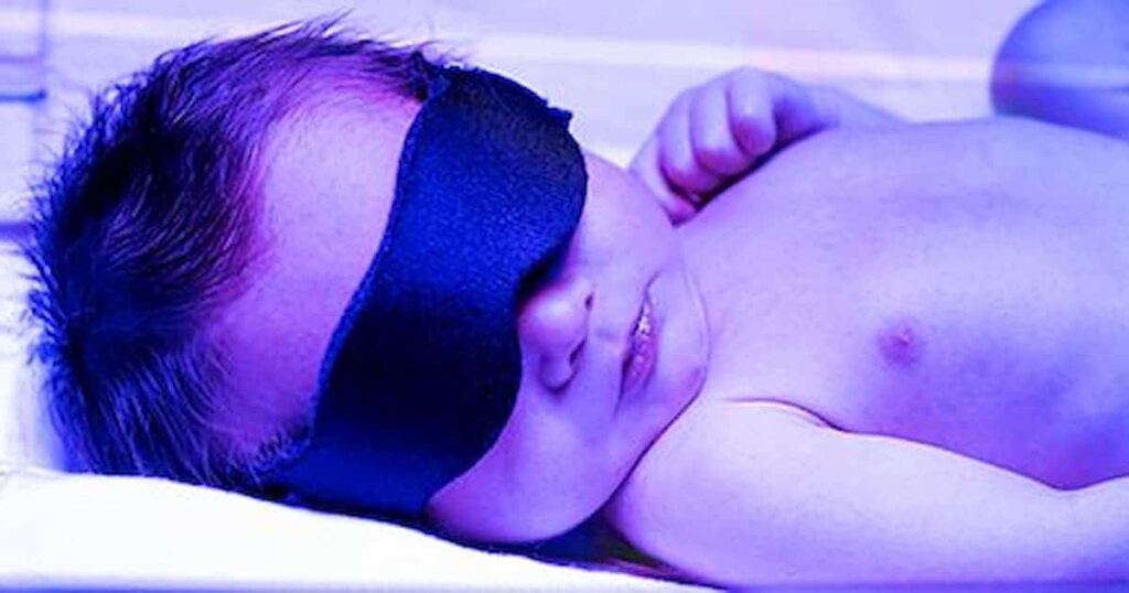 fototerapia neonatal