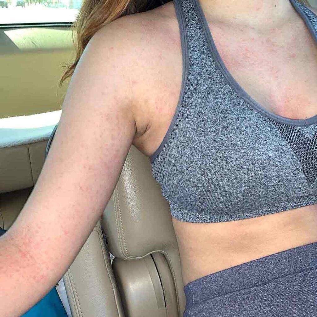 Una persona vestida con un sujetador deportivo y mallas grises está sentada en el asiento de un coche, con el brazo apoyado en el reposabrazos. La imagen muestra su torso, pero parte de su rostro queda fuera de plano.