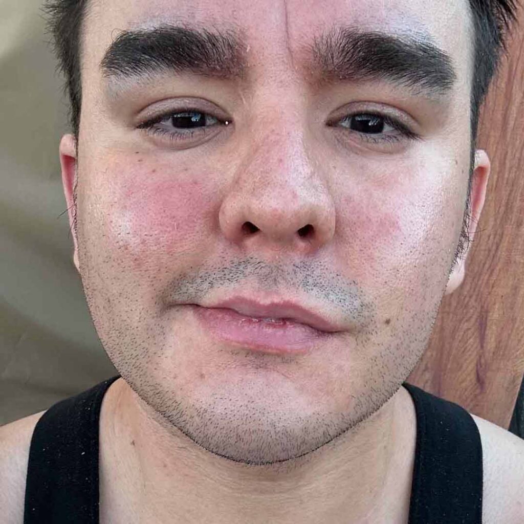 Primer plano de una persona con cabello corto y oscuro, cejas pobladas y algo de barba incipiente, que viste una camiseta negra sin mangas. La persona tiene una expresión neutra y las mejillas ligeramente sonrojadas.