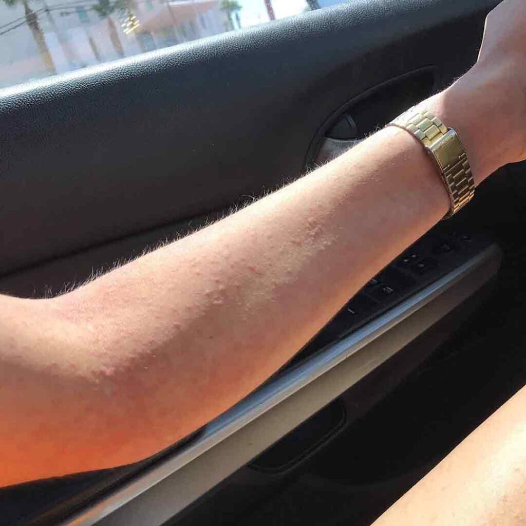 Primer plano del antebrazo de una persona que lleva un reloj de oro, apoyado en el interior de la puerta de un coche con la luz del sol incidiendo sobre el brazo.