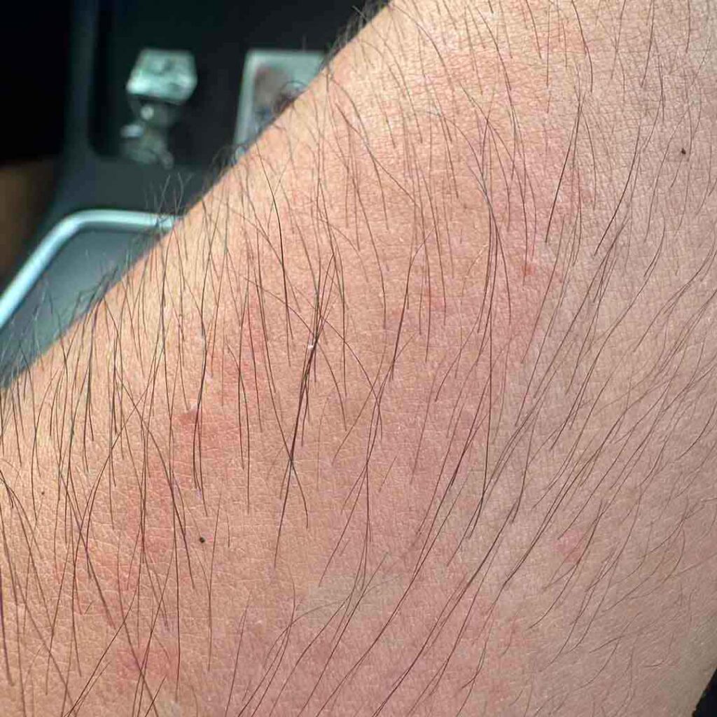 Un primer plano del antebrazo de una persona con cabello visible y piel ligeramente rosada, fotografiado dentro de un automóvil con parte del tablero y los botones borrosos en el fondo.
